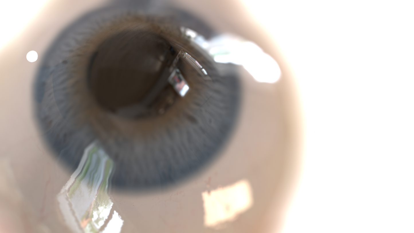 Eyeball Single Transition - Genariq
